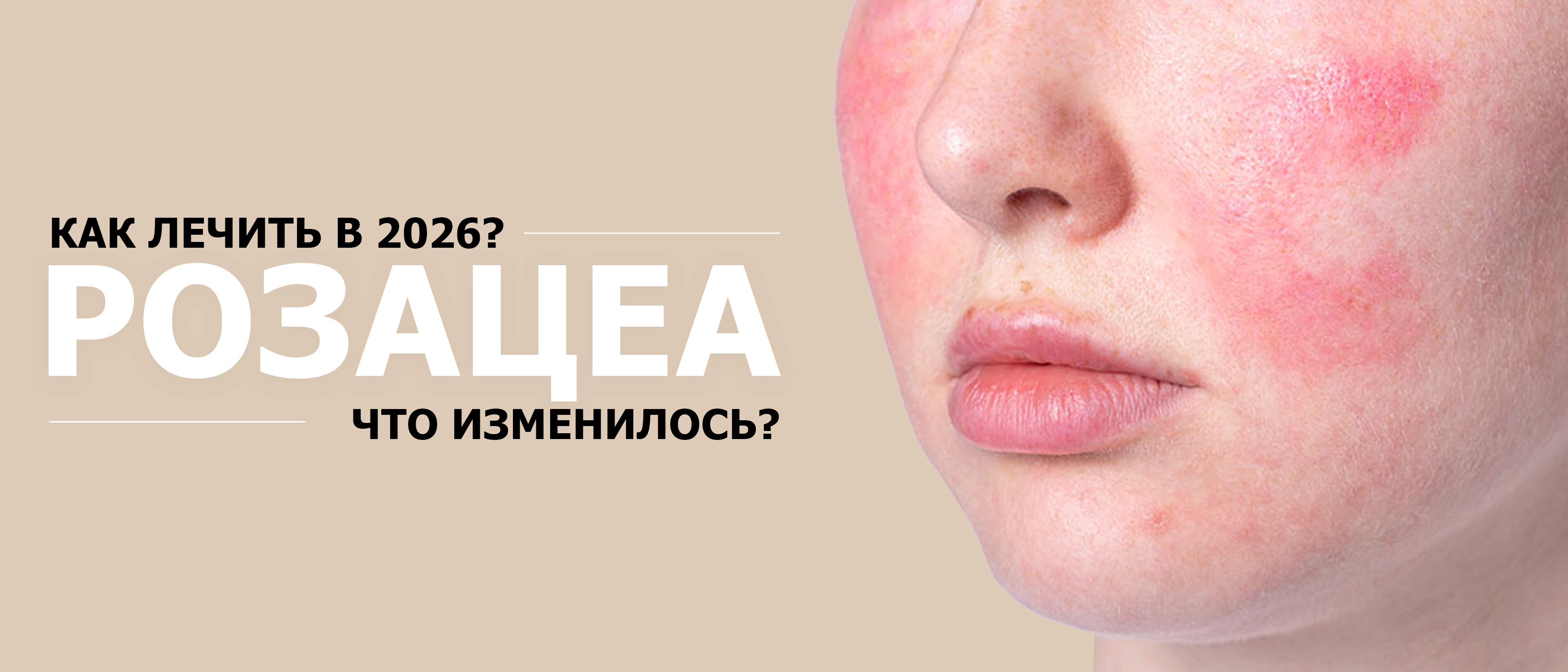 Акне до и после